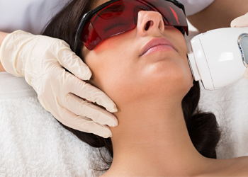 IPL hair removal and reduction treatments
